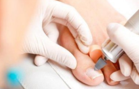 pedicure medischpedicure lauriesvoetverzorging